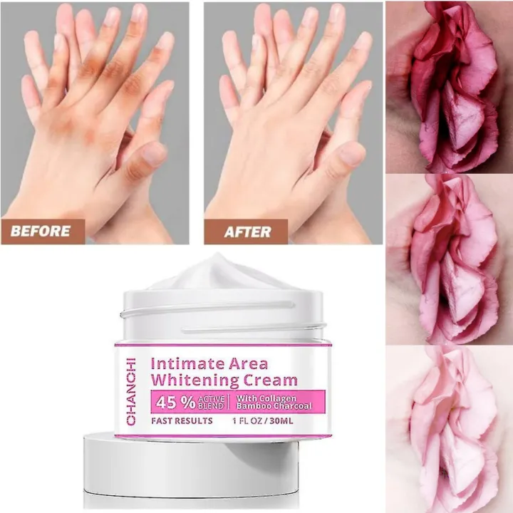 whitening cream for men & women skin brightening, moisturizing & dark spot removal face & body whitening cream for men & women skin brightening, moisturizing & dark spot removal face & body