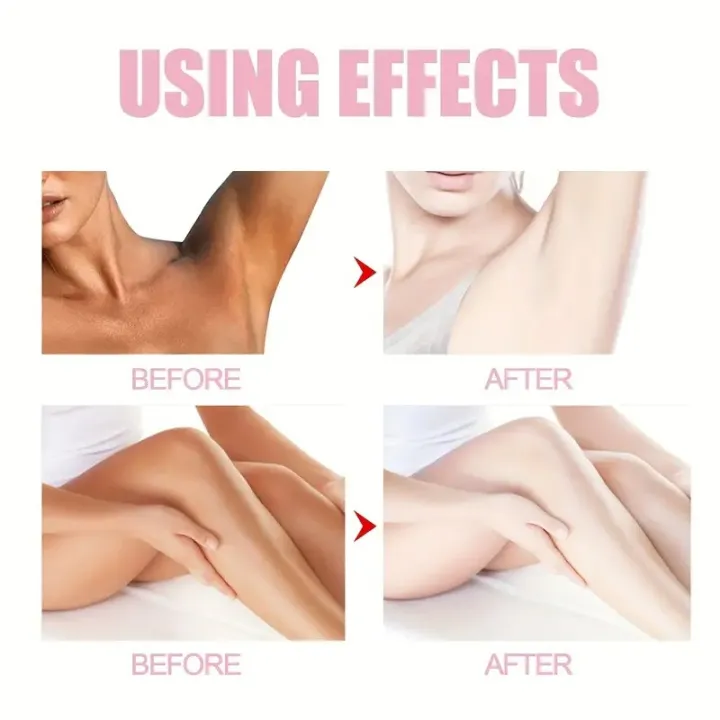 whitening cream for men & women skin brightening, moisturizing & dark spot removal face & body whitening cream for men & women skin brightening, moisturizing & dark spot removal face & body